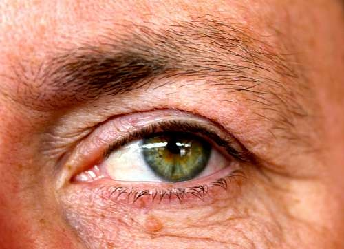 Ojo Verde