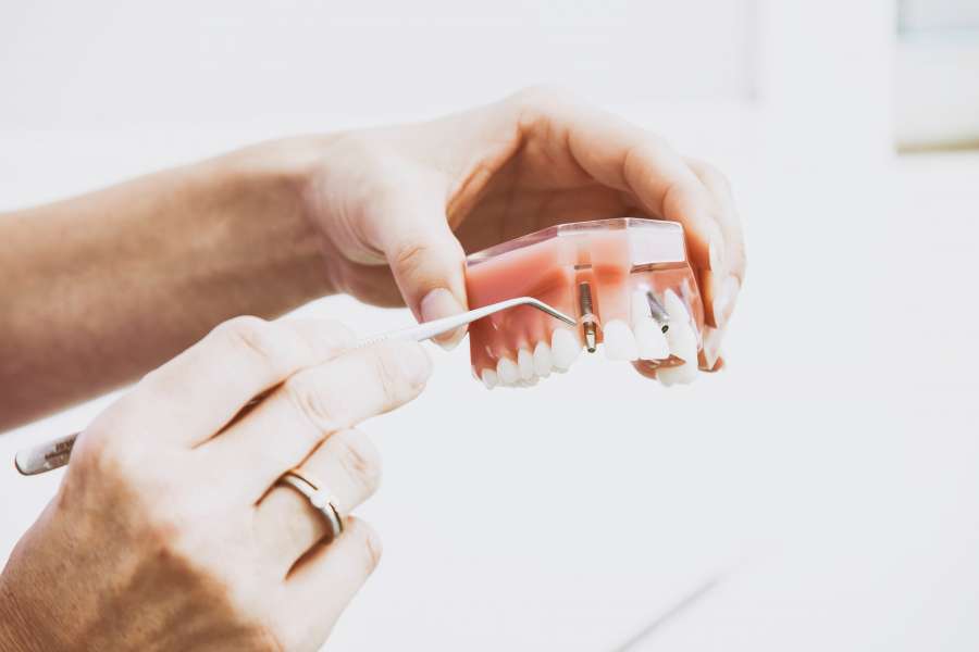 Mecanico dental, Dentista, Protesis, Trabajo, Profesion, Dentadura, Perno, 