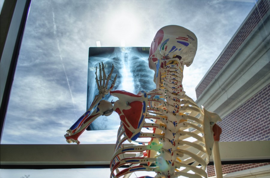 radiografia, esqueleto, concepto, medicina, salud, 