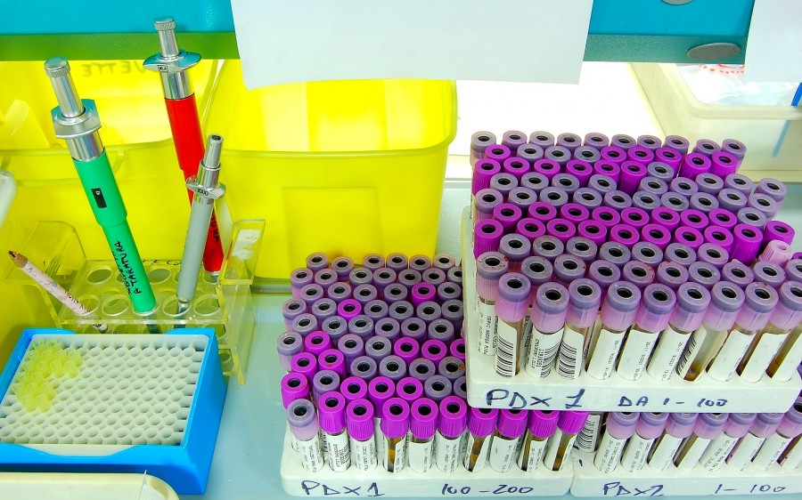tubo, tubos, ensayo, laboratorio, ciencia, quimica, medicina, interior, vacuna, vacunas, antibiotico, salud, 