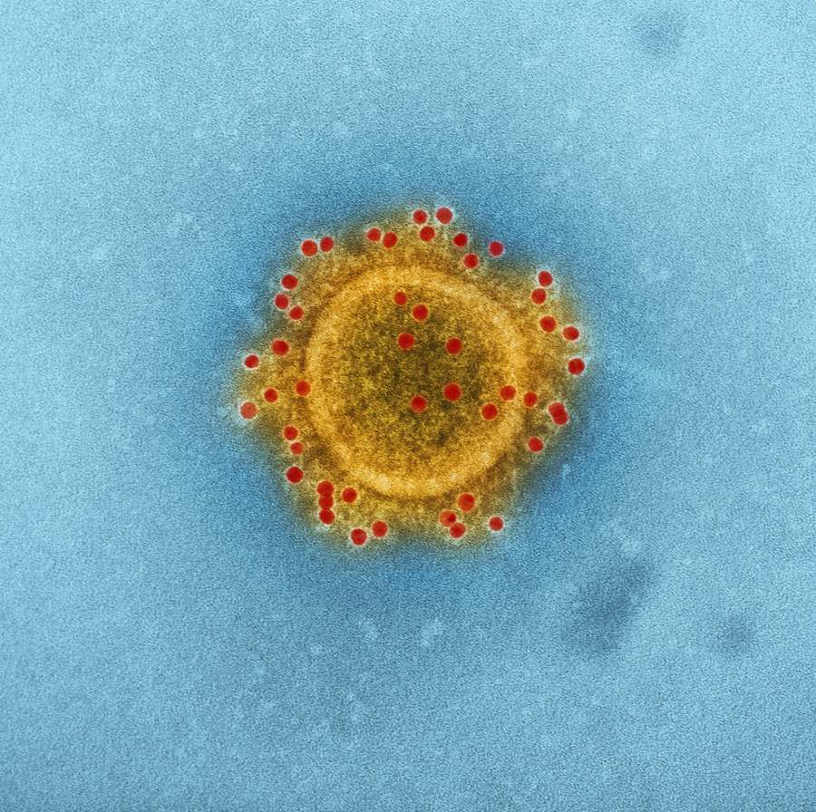 virus, macro, enfermedad, ciencia, biologia, imagen, gripe, microbiologia, Transmision, contagio, 